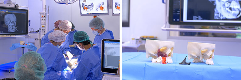 chiturgické 3D modely 3D tisk na BCN3D Epsilon W50