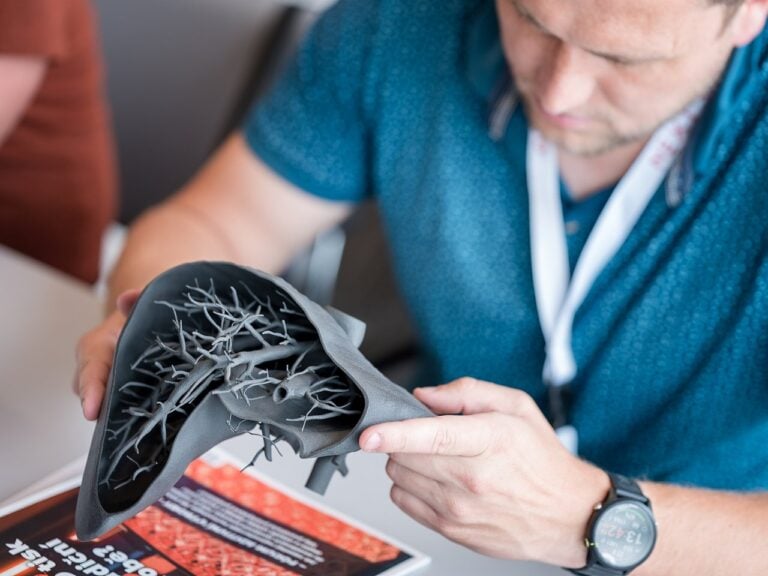 3D tisk předoperačních modelů orgánů z prášku